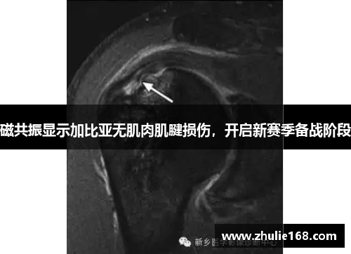 磁共振显示加比亚无肌肉肌腱损伤，开启新赛季备战阶段